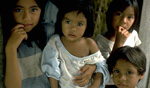 Guatemala-malnutrition